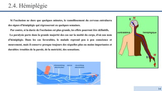 2.4. Hémiplégie
Si l'occlusion ne dure que quelques minutes, le ramollissement du cerveau entraînera
des signes d'hémiplégie qui régresseront en quelques semaines.
Par contre, si la durée de l'occlusion est plus grande, les effets pourront être définitifs.
La paralysie porte dans la grande majorité des cas sur la moitié du corps, d'où son nom
d'hémiplégie. Dans les cas favorables, le malade reprend peu à peu conscience et
mouvement, mais il conserve presque toujours des séquelles plus ou moins importantes et
durables: troubles de la parole, de la motricité, des sensations.
14
 