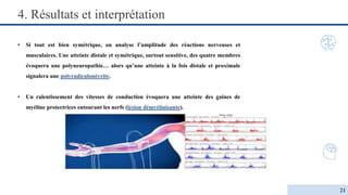 • Si tout est bien symétrique, on analyse l’amplitude des réactions nerveuses et
musculaires. Une atteinte distale et symétrique, surtout sensitive, des quatre membres
évoquera une polyneuropathie… alors qu’une atteinte à la fois distale et proximale
signalera une polyradiculonévrite.
• Un ralentissement des vitesses de conduction évoquera une atteinte des gaines de
myéline protectrices entourant les nerfs (lésion démyélinisante).
4. Résultats et interprétation
21
 