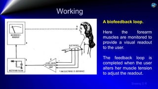 Sreeraj S R
Working
A biofeedback loop.
Here the forearm
muscles are monitored to
provide a visual readout
to the user.
The feedback loop is
completed when the user
alters her muscle tension
to adjust the readout.
 