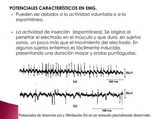 POTENCIALES CARACTERÍSTICOS EN EMG.
 Pueden ser debidos a la actividad voluntaria o a la
espontánea.
 La actividad de inserción (espontánea): Se origina al
penetrar el electrodo en el músculo y que dura, en sujetos
sanos, un poco más que el movimiento del electrodo. En
algunos sujetos enfermos es fácilmente inducida,
presentando una duración mayor y ondas puntiagudas.
 