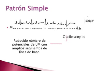  Músculo en reposo  contracción débil
Osciloscopio
Reducido número de
potenciales de UM con
amplios segmentos de
línea de base.
 