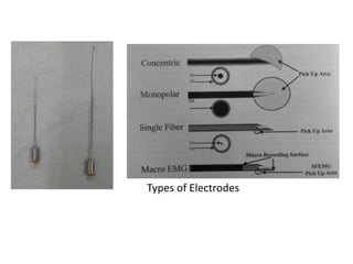 Types of Electrodes
 