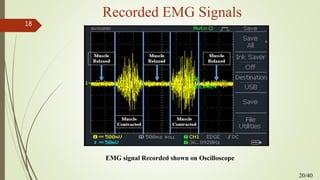 Recorded EMG Signals
EMG signal Recorded shown on Oscilloscope
20/40
18
 