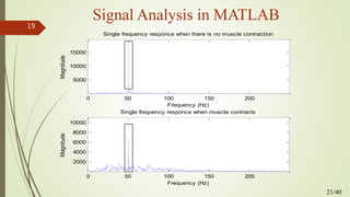 Signal Analysis in MATLAB
0 50 100 150 200
5000
10000
15000
Frequency (Hz)
Magnitude
Single frequency responce when there is no muscle contraction
0 50 100 150 200
2000
4000
6000
8000
10000
Frequency (Hz)
Magnitude
Single frequency responce when muscle contracts
21/40
19
 