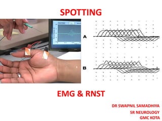 EMG & RNST
DR SWAPNIL SAMADHIYA
SR NEUROLOGY
GMC KOTA
SPOTTING
 