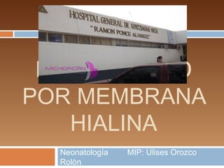 ENFERMEDAD
POR MEMBRANA
   HIALINA
  Neonatología   MIP: Ulises Orozco
  Rolòn
 