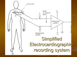 Simplified
Electrocardiographic
  recording system
            20
 