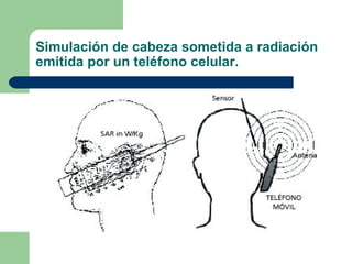 Simulación de cabeza sometida a radiación emitida por un teléfono celular. 