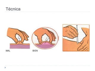 Técnica
 