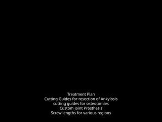 Treatment Plan
Cutting Guides for resection of Ankylosis
cutting guides for osteotomies
Custom Joint Prosthesis
Screw lengths for various regions
 