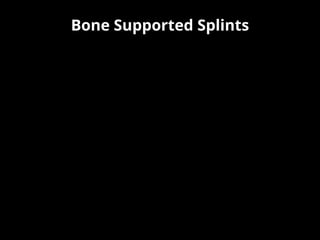 Bone Supported Splints
 