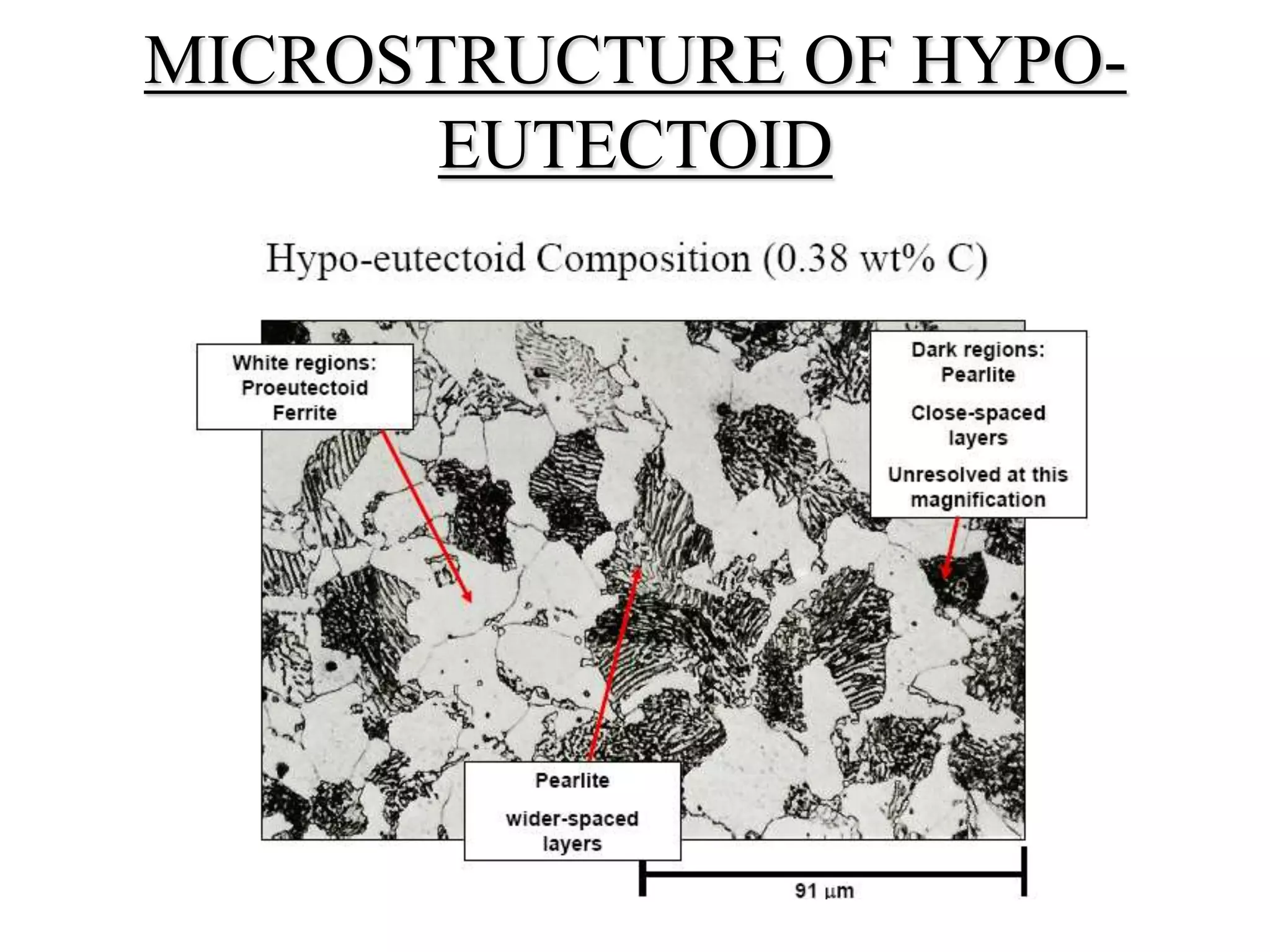 MICROSTRUCTURE OF HYPO-
EUTECTOID
 