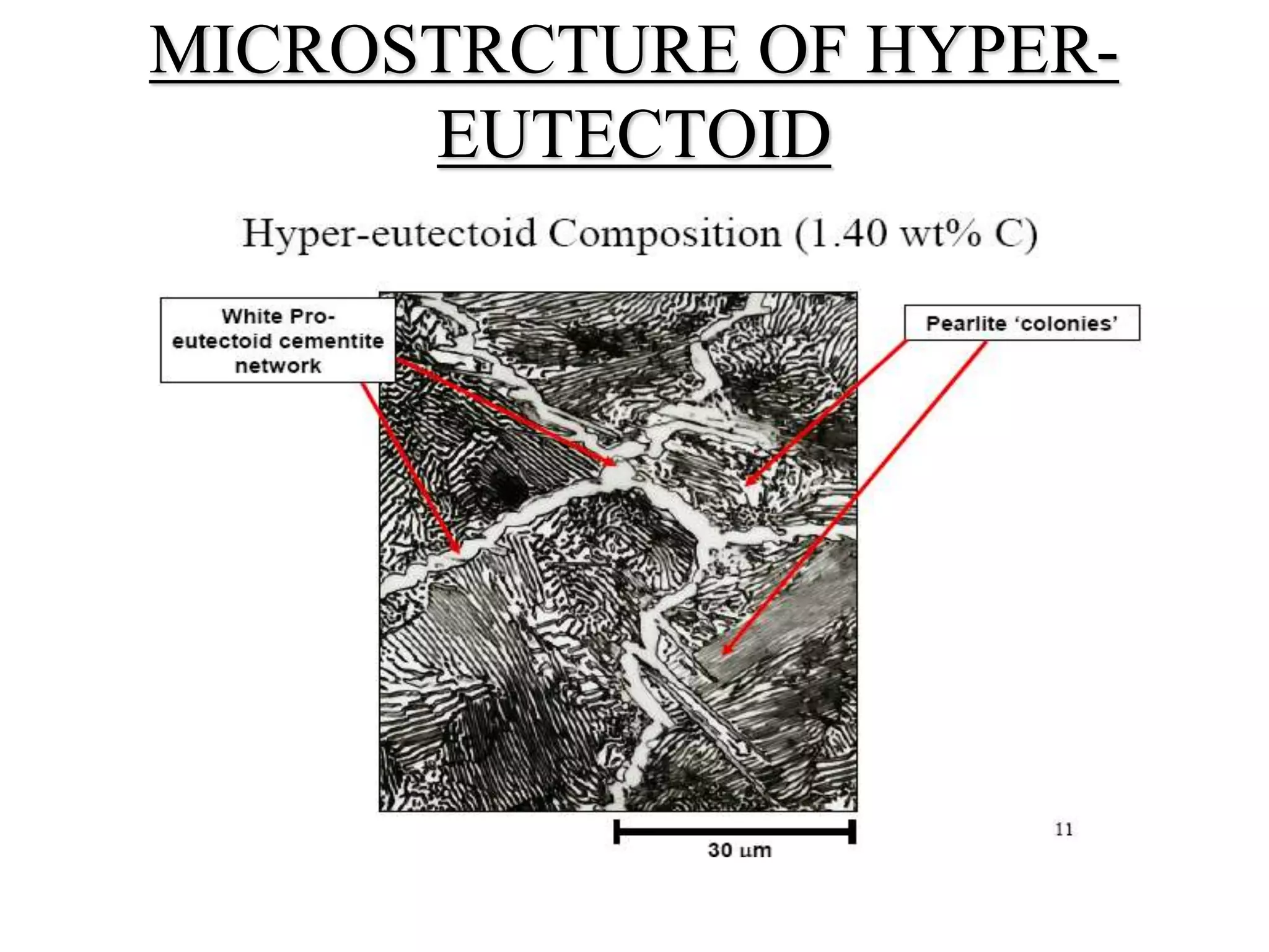 MICROSTRCTURE OF HYPER-
EUTECTOID
 