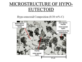 MICROSTRUCTURE OF HYPO-
EUTECTOID
 