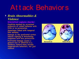 At t ack Behaviors
Brain Abnormalities &
Violence
Intermittent explosive disorder:
Condition marked by occasional
outbursts of violent behavior with
little or no provocation
Sometimes linked with temporal
lobe epilepsy
Damage to the prefrontal cortex
induces fighting & threatening
responses with less provocation
Prefrontal damage causes a
general loss of inhibition & a
tendency toward many socially
inappropriate behaviors, not just
violence
 