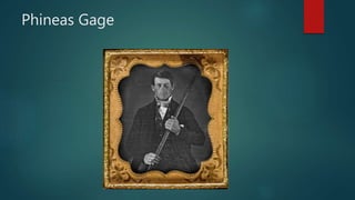 Phineas Gage
 