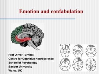 Prof Oliver Turnbull
Centre for Cognitive Neuroscience
School of Psychology
Bangor University
Wales, UK
Emotion and confabulation
 