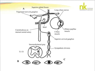 Superior orbital fissure
Long ciliary nerves
Trigeminal nerve & ganglion
Carotid plexus on
internal carotid artery
Skull
Dilator pupillae
muscleCiliary
muscle
Superior cervical ganglion
Sympathetic division
Intermediolateral gray
T1-T3
B
C
A
 