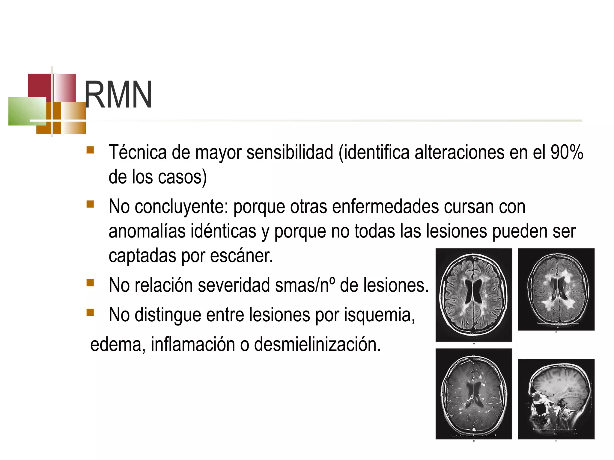 RMN
Técnica de mayor sensibilidad (identifica alteraciones en el 90%
de los casos)
 No concluyente: porque otras enfermedades cursan con
anomalías idénticas y porque no todas las lesiones pueden ser
captadas por escáner.
 No relación severidad smas/nº de lesiones.
 No distingue entre lesiones por isquemia,
edema, inflamación o desmielinización.


 