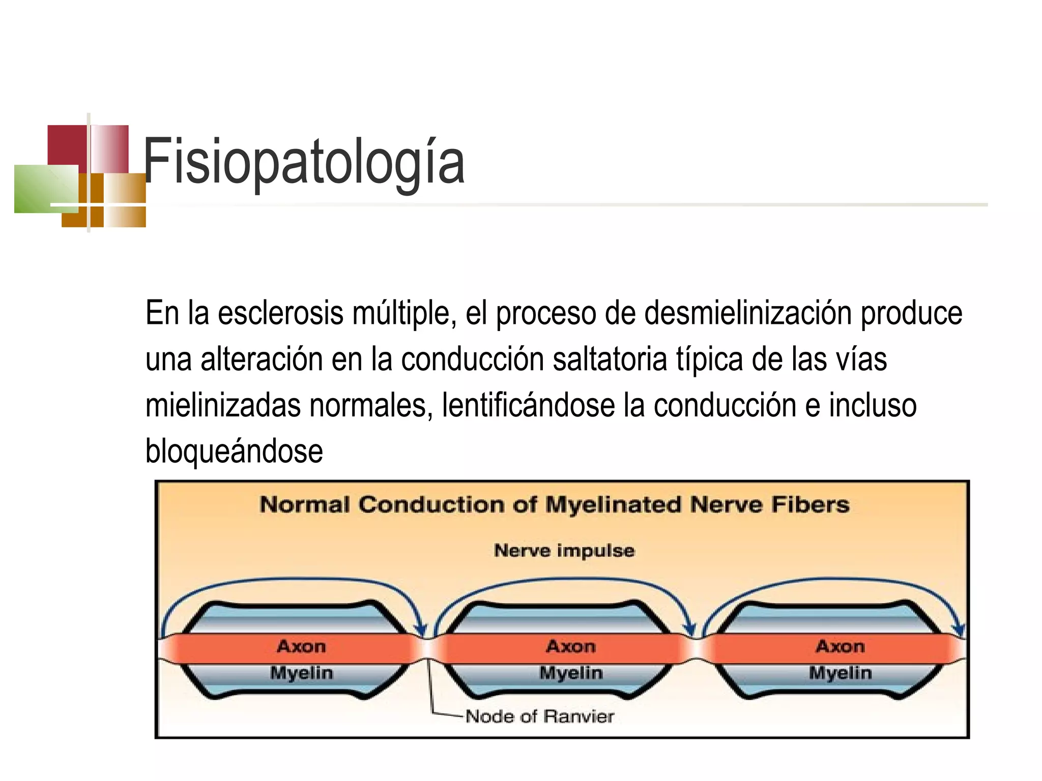 Fisiopatología
En la esclerosis múltiple, el proceso de desmielinización produce
una alteración en la conducción saltatoria típica de las vías
mielinizadas normales, lentificándose la conducción e incluso
bloqueándose

 