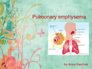 Pulmonary emphysema

by Anna Savchuk

 