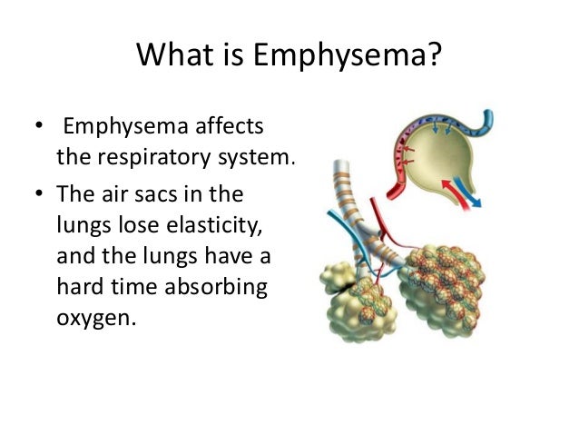 effects of smoking on the respiratory system essay Kidshealth / for kids / smoking stinks what's when people try smoking for the first time your lungs & respiratory system dealing with peer pressure. effects of smoking on the respiratory system essay Kidshealth / for kids / smoking stinks what's when people try smoking for the first time your lungs & respiratory system dealing with peer pressure.