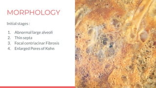 MORPHOLOGY
Initial stages :
1. Abnormal large alveoli
2. Thin septa
3. Focal centriacinar Fibrosis
4. Enlarged Pores of Kohn
 