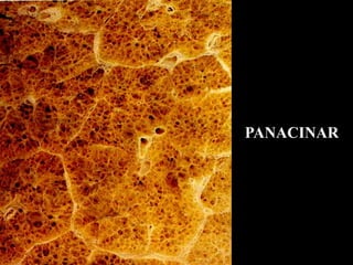 PANACINAR
 