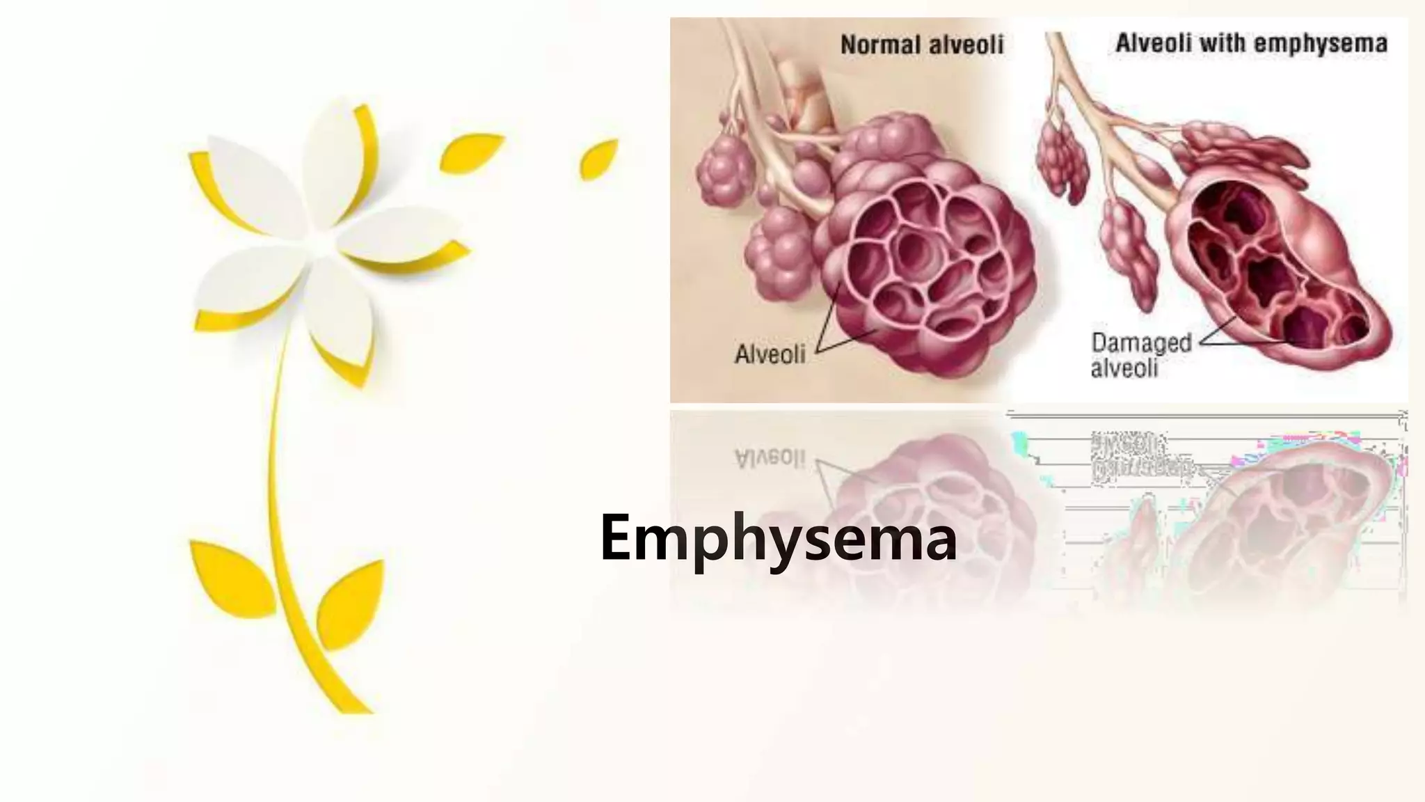 emphysema case study cog10.pptx