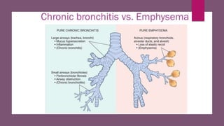 Emphysema and chronic bronchitis | PPTX