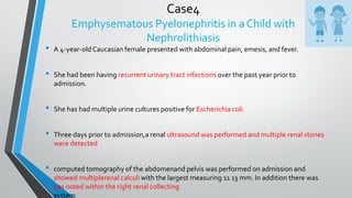 Case4
Emphysematous Pyelonephritis in a Child with
Nephrolithiasis
• A 4-year-oldCaucasian female presented with abdominal pain, emesis, and fever.
• She had been having recurrent urinary tract infections over the past year prior to
admission.
• She has had multiple urine cultures positive for Escherichia coli.
• Three days prior to admission,a renal ultrasound was performed and multiple renal stones
were detected
• computed tomography of the abdomenand pelvis was performed on admission and
showed multiplerenal calculi with the largest measuring 11 13 mm. In addition there was
gas noted within the right renal collecting
system
 