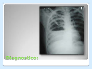 Diagnostico: