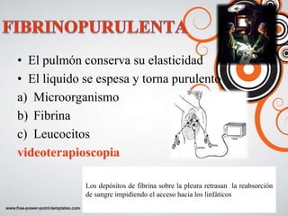 • El pulmón conserva su elasticidad
• El liquido se espesa y torna purulento
a) Microorganismo
b) Fibrina
c) Leucocitos
videoterapioscopia

             Los depósitos de fibrina sobre la pleura retrasan la reabsorción
             de sangre impidiendo el acceso hacia los linfáticos
 