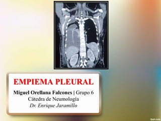 EMPIEMA PLEURAL
Miguel Orellana Falcones | Grupo 6
Cátedra de Neumología
Dr. Enrique Jaramillo

 