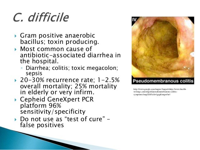 Ciprofloxacin And Zosyn For