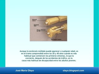 José María Olayo olayo.blogspot.com
Aunque la esclerosis múltiple puede aparecer a cualquier edad, es
en el tramo comprendido entre los 20 y 40 años cuando es más
habitual que comiencen los primeros síntomas, lo que la
convierte, después de los accidentes de tráfico, en la
causa más habitual de discapacidad entre los adultos jóvenes.
 