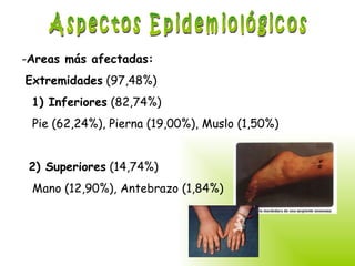 Aspectos Epidemiológicos Areas más afectadas: Extremidades  (97,48%) 1) Inferiores  (82,74%) Pie (62,24%), Pierna (19,00%), Muslo (1,50%) 2) Superiores  (14,74%) Mano (12,90%), Antebrazo (1,84%)   