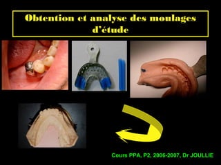 Obtention et analyse des moulages
d’étude
Cours PPA, P2, 2006-2007, Dr JOULLIE
 