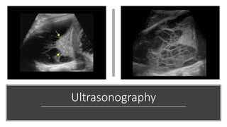 Ultrasonography
 