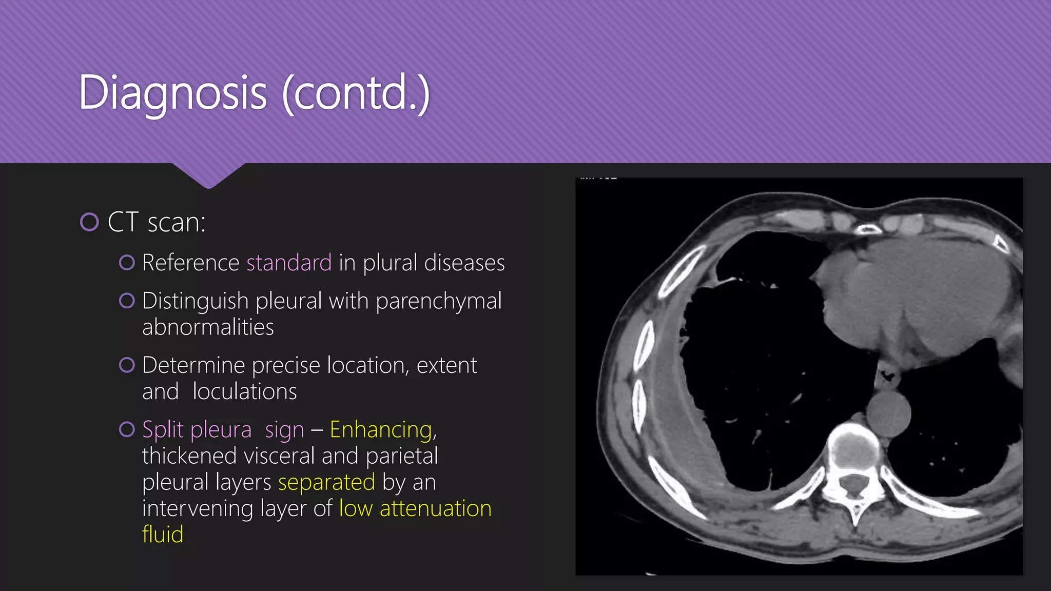 Diagnosis (contd.)
 CT scan:
 Reference standard in plural diseases
 Distinguish pleural with parenchymal
abnormalities
 Determine precise location, extent
and loculations
 Split pleura sign – Enhancing,
thickened visceral and parietal
pleural layers separated by an
intervening layer of low attenuation
fluid
 