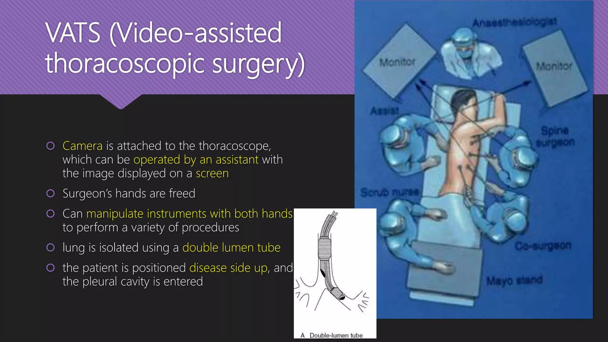VATS (Video-assisted
thoracoscopic surgery)
 Camera is attached to the thoracoscope,
which can be operated by an assistant with
the image displayed on a screen
 Surgeon’s hands are freed
 Can manipulate instruments with both hands
to perform a variety of procedures
 lung is isolated using a double lumen tube
 the patient is positioned disease side up, and
the pleural cavity is entered
 