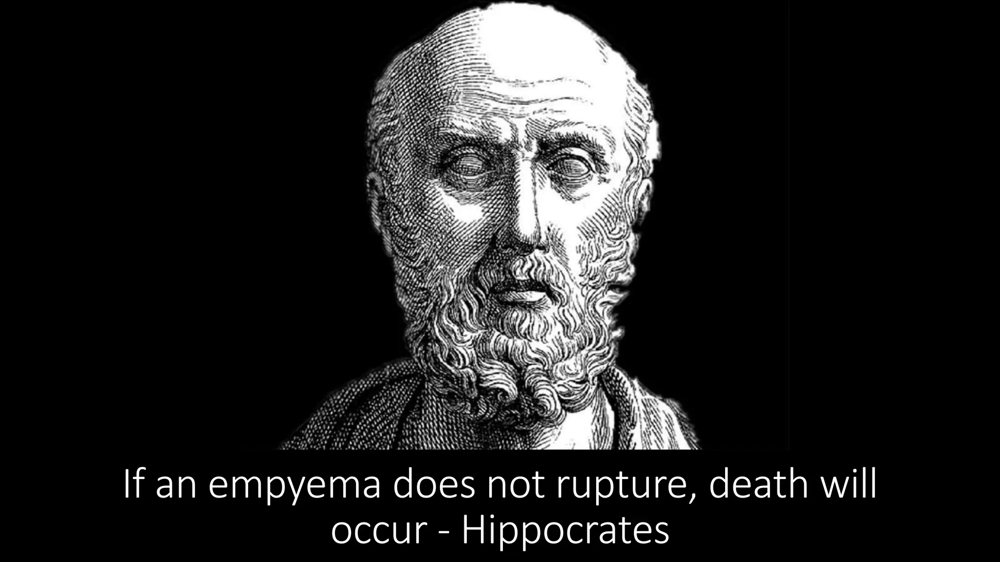 If an empyema does not rupture, death will
occur - Hippocrates
 