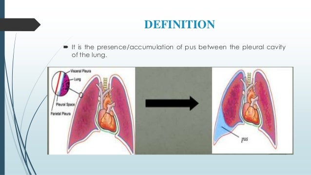 Empyema dr yusuf imran