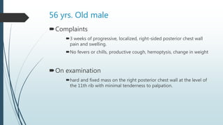 56 yrs. Old male
Complaints
3 weeks of progressive, localized, right-sided posterior chest wall
pain and swelling.
No fevers or chills, productive cough, hemoptysis, change in weight
On examination
hard and fixed mass on the right posterior chest wall at the level of
the 11th rib with minimal tenderness to palpation.
 