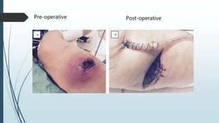 Pre-operative Post-operative
 