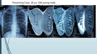 Presenting Case, 18 yrs. Old young male
 