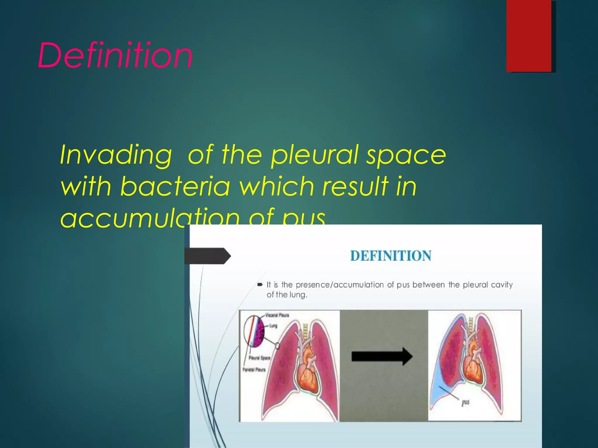 Definition
Invading of the pleural space
with bacteria which result in
accumulation of pus .
 