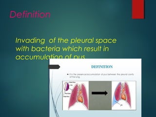 Definition
Invading of the pleural space
with bacteria which result in
accumulation of pus .
 