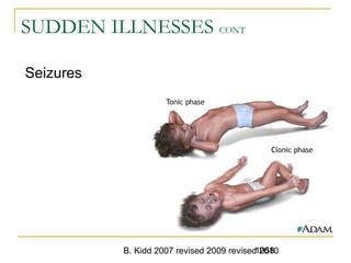 B. Kidd 2007 revised 2009 revised 20101058
SUDDEN ILLNESSES CONT
Seizures
 