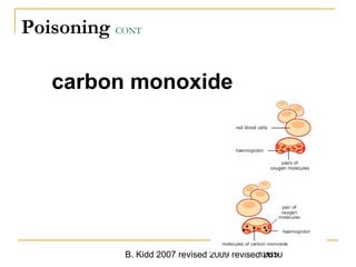 B. Kidd 2007 revised 2009 revised 20101085
Poisoning CONT
carbon monoxide
 